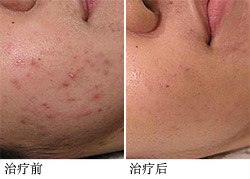 杭州京都医院皮肤科