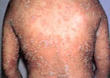 ������ţƤѢ