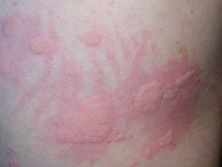 ݡ����֢״����