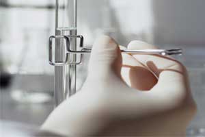 过敏性紫癜如何检查